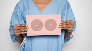 Cáncer de mama triple negativo: Expertas reclaman en el Congreso un mayor y más rápido acceso para las paciente a los tratamientos innovadores