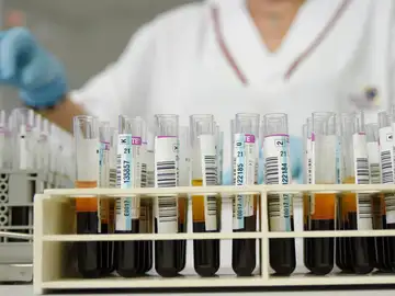 Un análisis de sangre rutinario permite diagnosticar Alzheimer en personas con síntomas tempranos Un análisis de sangre rutinario permite diagnosticar Alzheimer en personas con síntomas tempranos