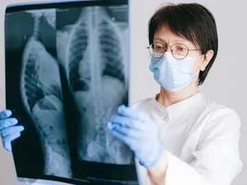 La Inteligencia Artificial de alta precisión mejora la detección del cáncer de pulmón La Inteligencia Artificial de alta precisión mejora la detección del cáncer de pulmón