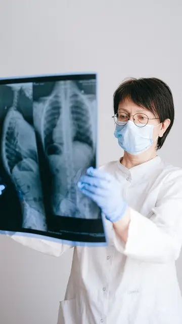 La Inteligencia Artificial de alta precisión mejora la detección del cáncer de pulmón La Inteligencia Artificial de alta precisión mejora la detección del cáncer de pulmón