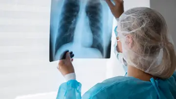 Cómo prevenir el neumococo, la bacteria que puede provocar desde neumonía hasta otitis y meningitis Cómo prevenir el neumococo, la bacteria que puede provocar desde neumonía hasta otitis y meningitis