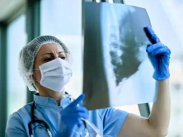 Una doctora revisando una radiografía de pulmones Una doctora revisando una radiografía de pulmones