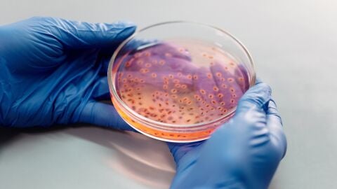 Superbacterias