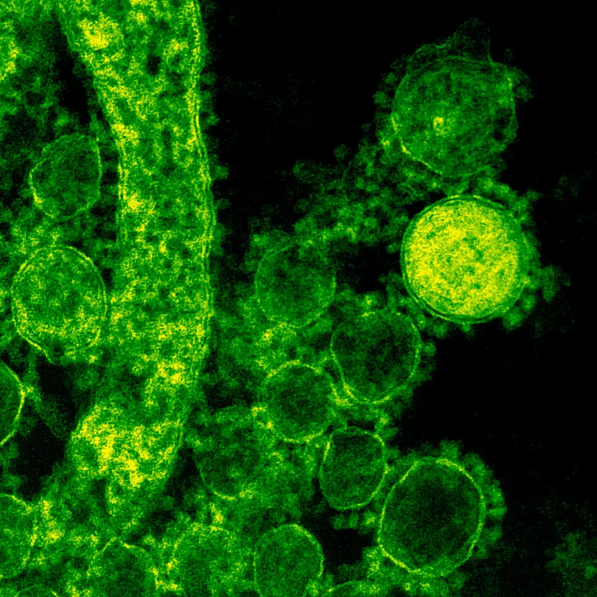 El veneno de avispa se transforma en un antibiótico para combatir bacterias  multirresistentes, Ciencia