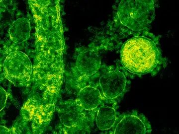 Una de las bacterias más multirresistente tendrá por fin un antibiótico que la erradique eficazmente Una de las bacterias más multirresistente tendrá por fin un antibiótico que la erradique eficazmente