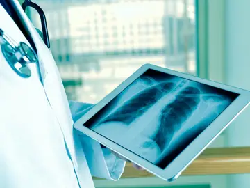 Médico mirando una radiografía de pulmón Médico mirando una radiografía de pulmón