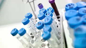 muestras de sangre muestras de sangre