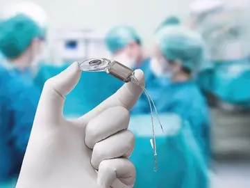 La SEORL-CCC destaca que los implantes cocleares mejoran la salud mental y la calidad de vida de los adultos La SEORL-CCC destaca que los implantes cocleares mejoran la salud mental y la calidad de vida de los adultos