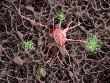 El alzheimer familiar puede transferirse mediante trasplante de medula osea en ratones El alzheimer familiar puede transferirse mediante trasplante de medula osea en ratones