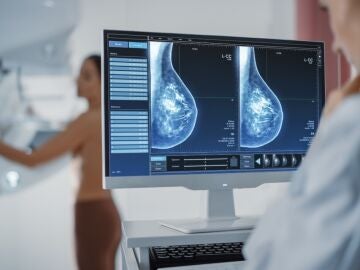 mamografía, cáncer de mama