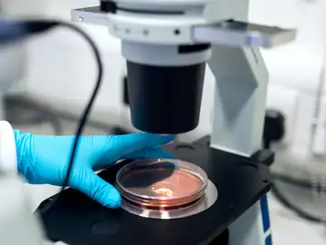 Una inversion en salud mundial: La OMS destina casi dos millones de euros en diez proyectos para la vigilancia genómica de patógenos Una inversion en salud mundial: La OMS destina casi dos millones de euros en diez proyectos para la vigilancia genómica de patógenos