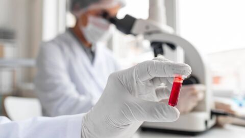 La colonoscopia y el test de sangre en heces son pruebas equivalentes para detectar cancer de colon