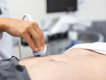 El cáncer de estómago se detecta antes y mejora sus perspectivas de curación El cáncer de estómago se detecta antes y mejora sus perspectivas de curación