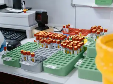 Una simple muestra de sangre permite diagnosticar miles de enfermedades genéticas en bebés Una simple muestra de sangre permite diagnosticar miles de enfermedades genéticas en bebés