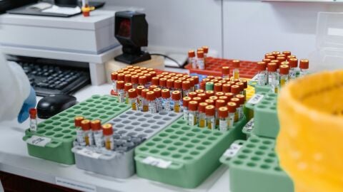 Una simple muestra de sangre permite diagnosticar miles de enfermedades genéticas en bebés