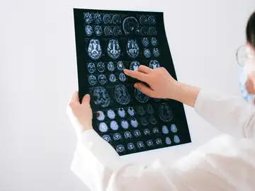 Los cerebros envejecieron más rápido durante la pandemia, incluso en las personas no contagiadas Los cerebros envejecieron más rápido durante la pandemia, incluso en las personas no contagiadas