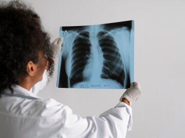 Nuevo frente contra el cáncer de pulmón más agresivo