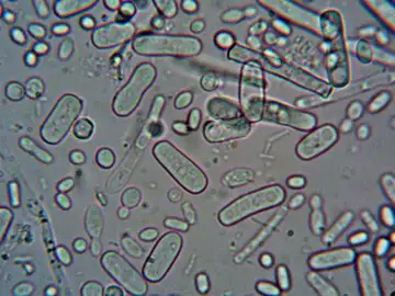 Sistema inmune Sistema inmune