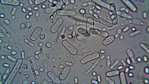 Sistema inmune