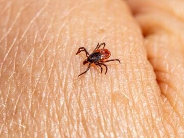 Un nuevo test molecular permite diagnosticar la enfermedad de Lyme en fases tempranas