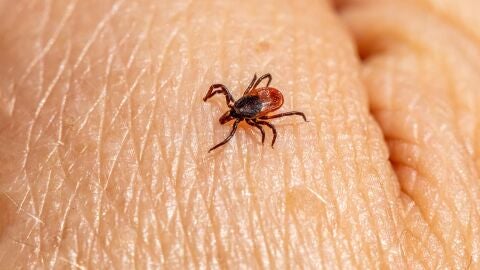 Un nuevo test molecular permite diagnosticar la enfermedad de Lyme en fases tempranas