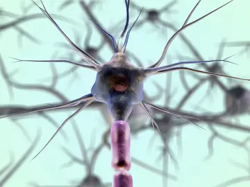 Un modelo celular innovador abre la puerta a acelerar la investigación de la enfermedad de Lafora Un modelo celular innovador abre la puerta a acelerar la investigación de la enfermedad de Lafora
