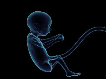 Los beneficios de la transfusi&oacute;n de sangre del cord&oacute;n umbilical a prematuros extremos 