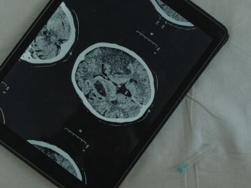 Doctora Carmen Bala&ntilde;&aacute;: "es imprescindible hacer un estudio del ADN en la mayor&iacute;a de tumores"
