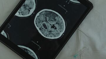 Doctora Carmen Bala&ntilde;&aacute;: "es imprescindible hacer un estudio del ADN en la mayor&iacute;a de tumores"
