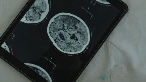 Doctora Carmen Balañá: "es imprescindible hacer un estudio del ADN en la mayoría de tumores"