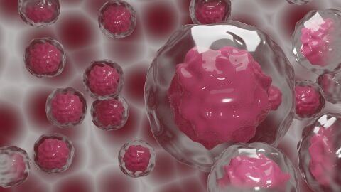 Un ensayo estudiará si las células madre del propio paciente pueden mejorar la cirugía de las metástasis hepáticas por cáncer de colon