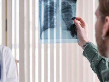 Profesional médico examinando una imagen de radiografía de los pulmones humanos en un entorno clínico. Profesional médico examinando una imagen de radiografía de los pulmones humanos en un entorno clínico.