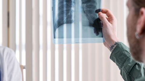 Profesional médico examinando una imagen de radiografía de los pulmones humanos en un entorno clínico.