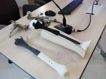 Vista de la primera prótesis personalizada en el mundo realizada con un nuevo metamaterial. Vista de la primera prótesis personalizada en el mundo realizada con un nuevo metamaterial.