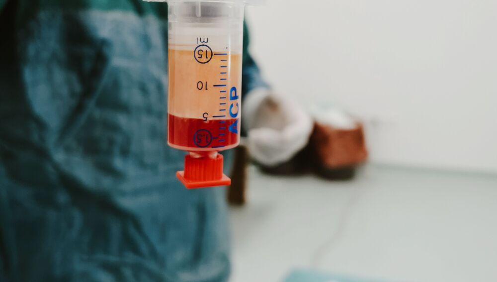 Primer plano de una jeringa con sangre en un laboratorio. Configuración médica centrada en procedimientos de atención médica