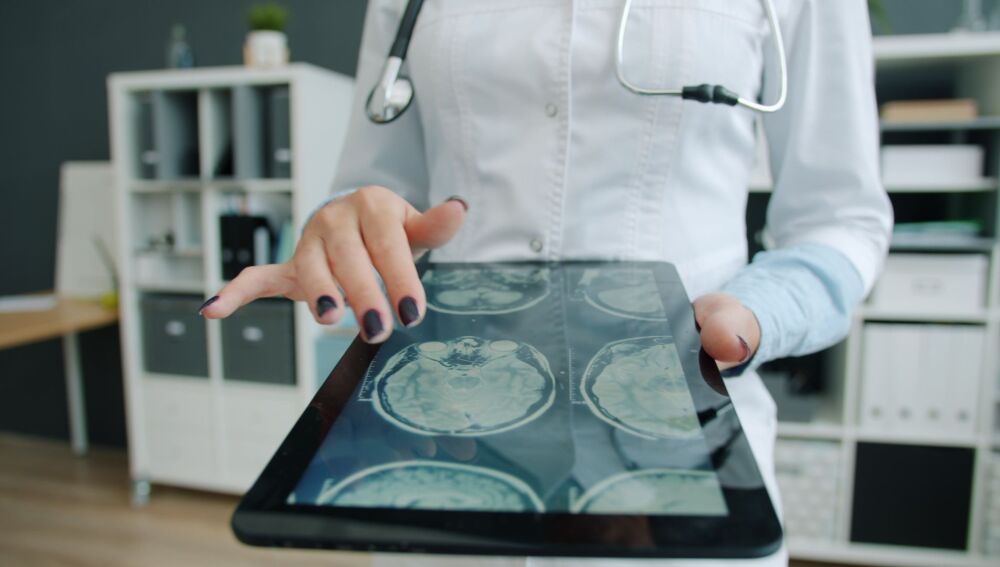 Un atlas con más de 6,3 millones de núcleos celulares abre nuevas vías para entender las enfermedades cerebrales