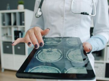 Un atlas con m&aacute;s de 6,3 millones de n&uacute;cleos celulares abre nuevas v&iacute;as para entender las enfermedades cerebrales