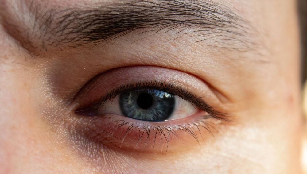 El frío se asocia con un aumento de la presión intraocular en pacientes con glaucoma grave