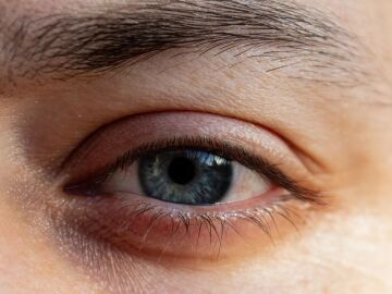 El fr&iacute;o se asocia con un aumento de la presi&oacute;n intraocular en pacientes con glaucoma grave