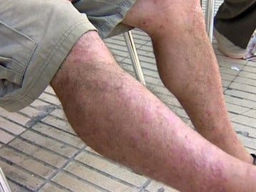 La mosca negra alarma a los empresarios de Tortosa La mosca negra alarma a los empresarios de Tortosa