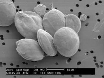 Alga tóxica "Gambierdiscus excentricus" Alga tóxica "Gambierdiscus excentricus"