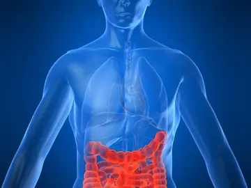 Consiguen frenar la metástasis del cáncer de colon Consiguen frenar la metástasis del cáncer de colon