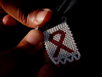 Los recortes en Sanidad afectan al control del VIH
