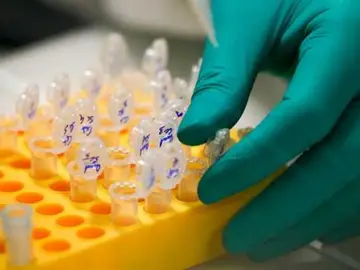 Identifican una proteína clave en el desarrollo del cáncer de páncreas Identifican una proteína clave en el desarrollo del cáncer de páncreas