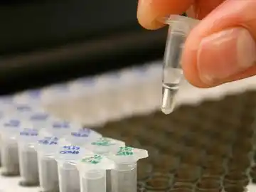 Tres fármacos logran reducir hasta un 32% el tamaño de tumores en el colon Tres fármacos logran reducir hasta un 32% el tamaño de tumores en el colon