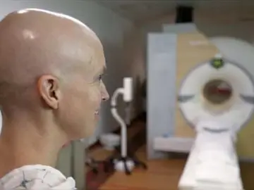 Mujer con leucemia Mujer con leucemia
