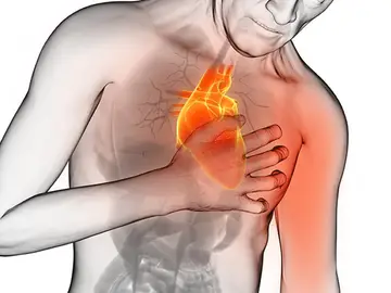 Ataque corazón Ataque corazón