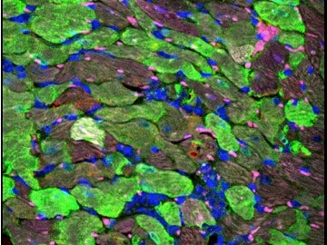  Imagen aumentada del corazón. Las células en color verde representan los cardiomiocitos que han sido sometidos a la terapia génica. 