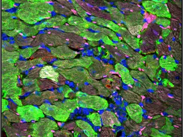 Imagen aumentada del corazón. Las células en color verde representan los cardiomiocitos que han sido sometidos a la terapia génica. Imagen aumentada del corazón. Las células en color verde representan los cardiomiocitos que han sido sometidos a la terapia génica.