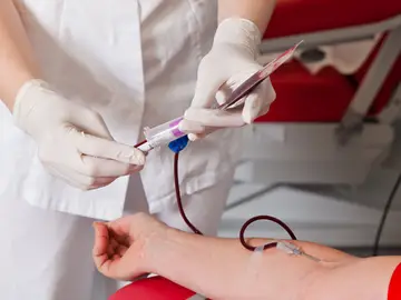 desarrolla una nueva técnica para diagnosticar alzhéimer con un simple análisis de sangre desarrolla una nueva técnica para diagnosticar alzhéimer con un simple análisis de sangre